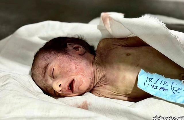 Medan spädbarn dör i Gaza. . . Rosenbad/EU: miljarder till krig framför humanism